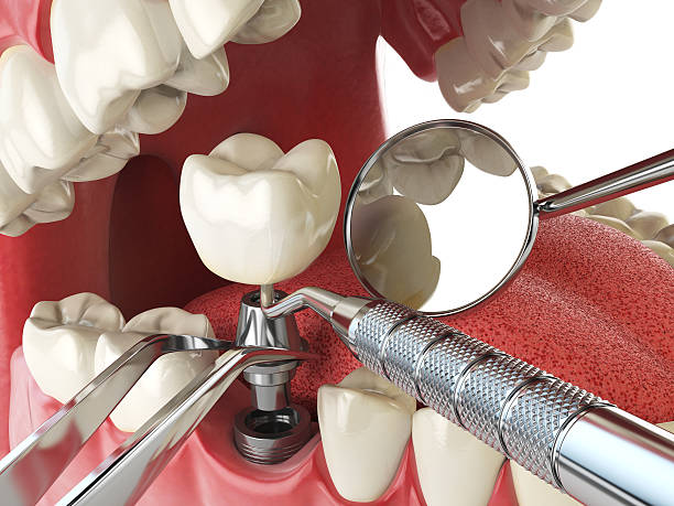 Best Urgent Dental Care for Toothache in Eureka Mill, SC